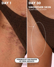 Close-up of hip skin using Truly Beauty’s Glazed Donut After Shave Oil. Left: Day 1—bumpy, red, ingrown hairs. Right: Day 30—smoother, even-toned skin. Text highlights validated results and post-shave hydration benefits.