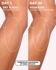 Close-up of a leg on Day 1 shows dull, textured skin, while Day 30 reveals hydrated, smoother skin after using Truly Beauty's Glazed Donut After Shave Oil—showing real post-shave hydration and visibly fewer ingrown hair concerns.