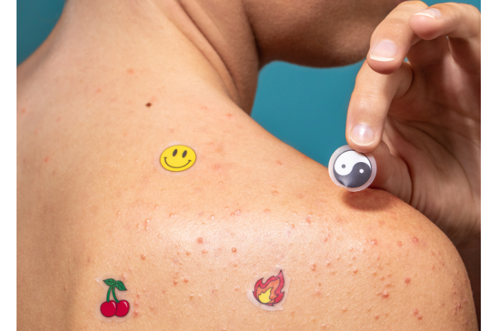 Shoulder with acne spots covered by colorful pimple patches, including smiley, cherry, flame, and yin-yang designs.