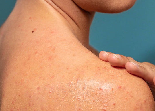 bakuchiol benefits for skin | truly's vanilla baby body oil with bakuchiol in coconut shell with sandy background