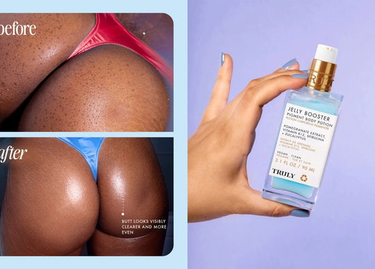 How to Get Rid of Butt Acne Scars