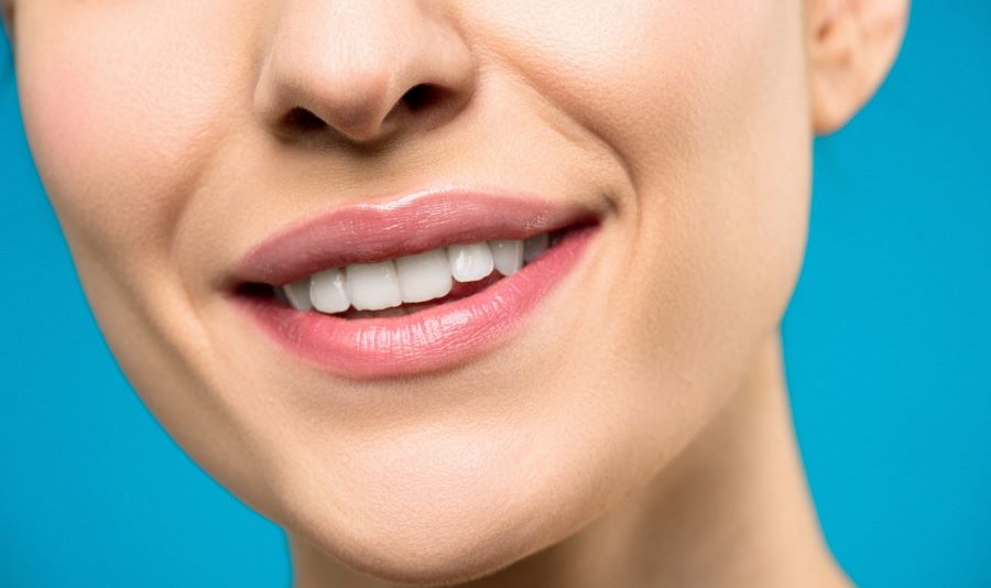 How to get rid of fine lines around mouth | closeup of woman smiling
