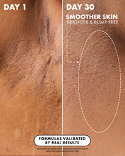 Side-by-side comparison of skin on Day 1 vs. Day 30 with Truly Beauty’s Coco Cloud Ingrown Prevention and Brightening Deodorant: see reduced discoloration, smoother, brighter skin. Real results validate the formula’s effectiveness.