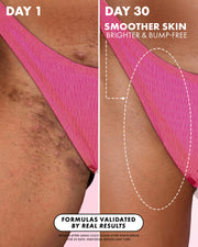 Side-by-side close-up of a woman’s bikini line in pink bottoms: left shows bumps and uneven skin (Day 1); right is smoother after using Truly Beauty's Coco Cloud After Shave Serum for 30 days. Text highlights improved skin.