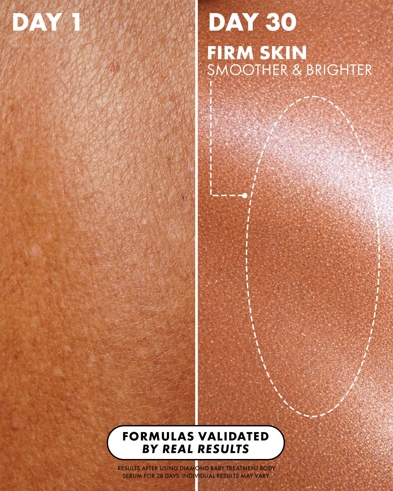 Close-up of skin texture: Day 1 (left) shows rough skin; Day 30 (right), after using Truly Beauty Diamond Baby Treatment Body Serum, reveals smoother, firmer, and brighter skin. A dotted oval highlights improved texture.