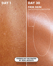Close-up of skin texture: Day 1 (left) shows rough skin; Day 30 (right), after using Truly Beauty Diamond Baby Treatment Body Serum, reveals smoother, firmer, and brighter skin. A dotted oval highlights improved texture.
