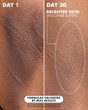 Close-up of skin compares “Day 1” roughness to smoother, brighter “Day 30” after using Truly Beauty’s Jelly Booster Pigment Body Potion, which helps lighten hyperpigmentation and acne scars.