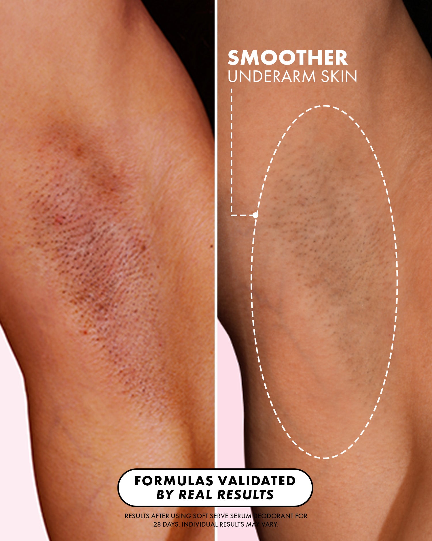 Side-by-side underarm comparison: left shows rough skin; right, smoother skin with fewer bumps, highlighted by a dotted oval. Text: Smoother Underarm Skin with Truly Beauty Soft Serve Serum Deodorant and real results-based formulas.