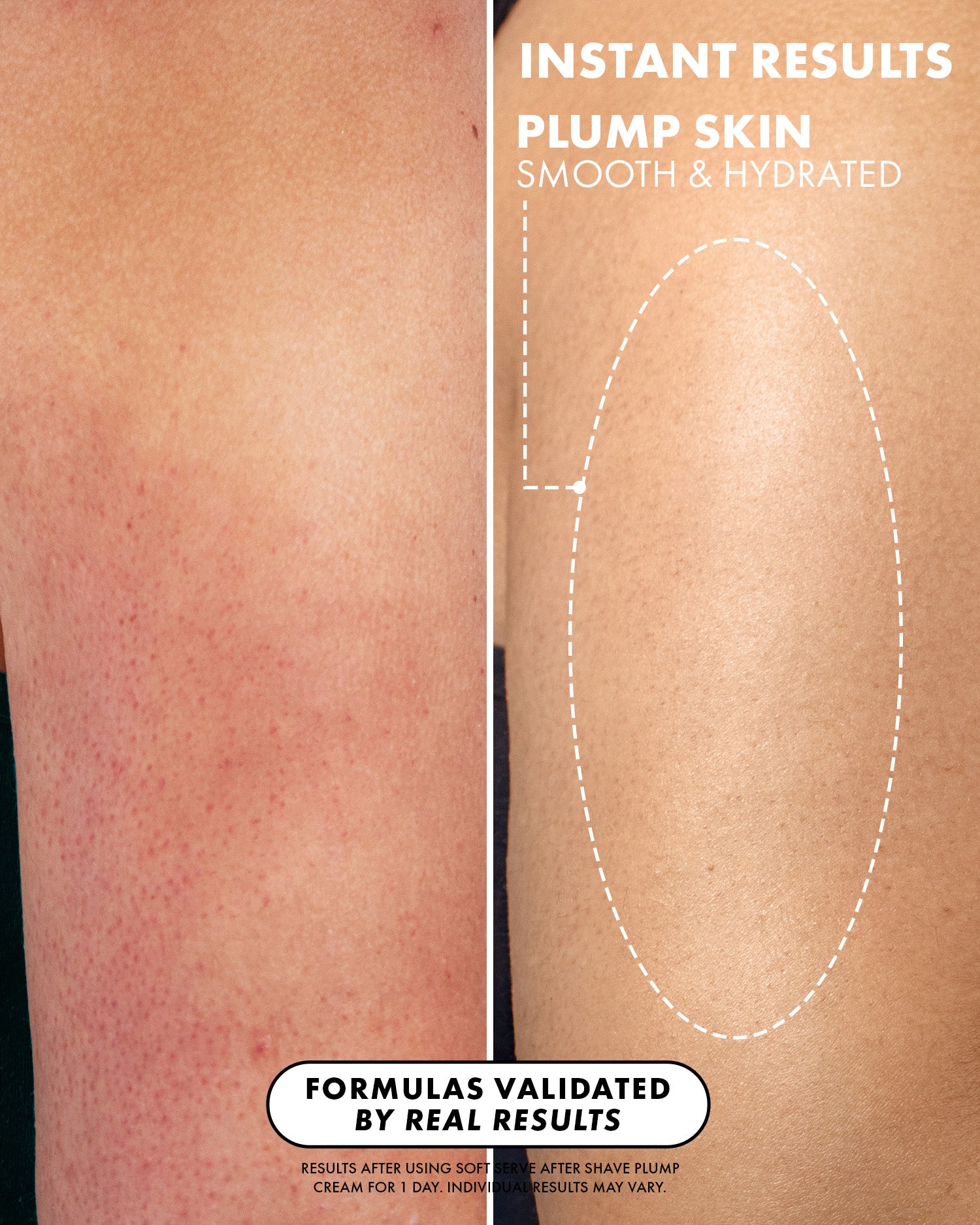 Side-by-side close-up of skin: the left shows red, irritated bumps, while the right looks smooth and hydrated with text highlighting instant results from Truly Beauty’s Soft Serve After Shave Hydrating Cream.