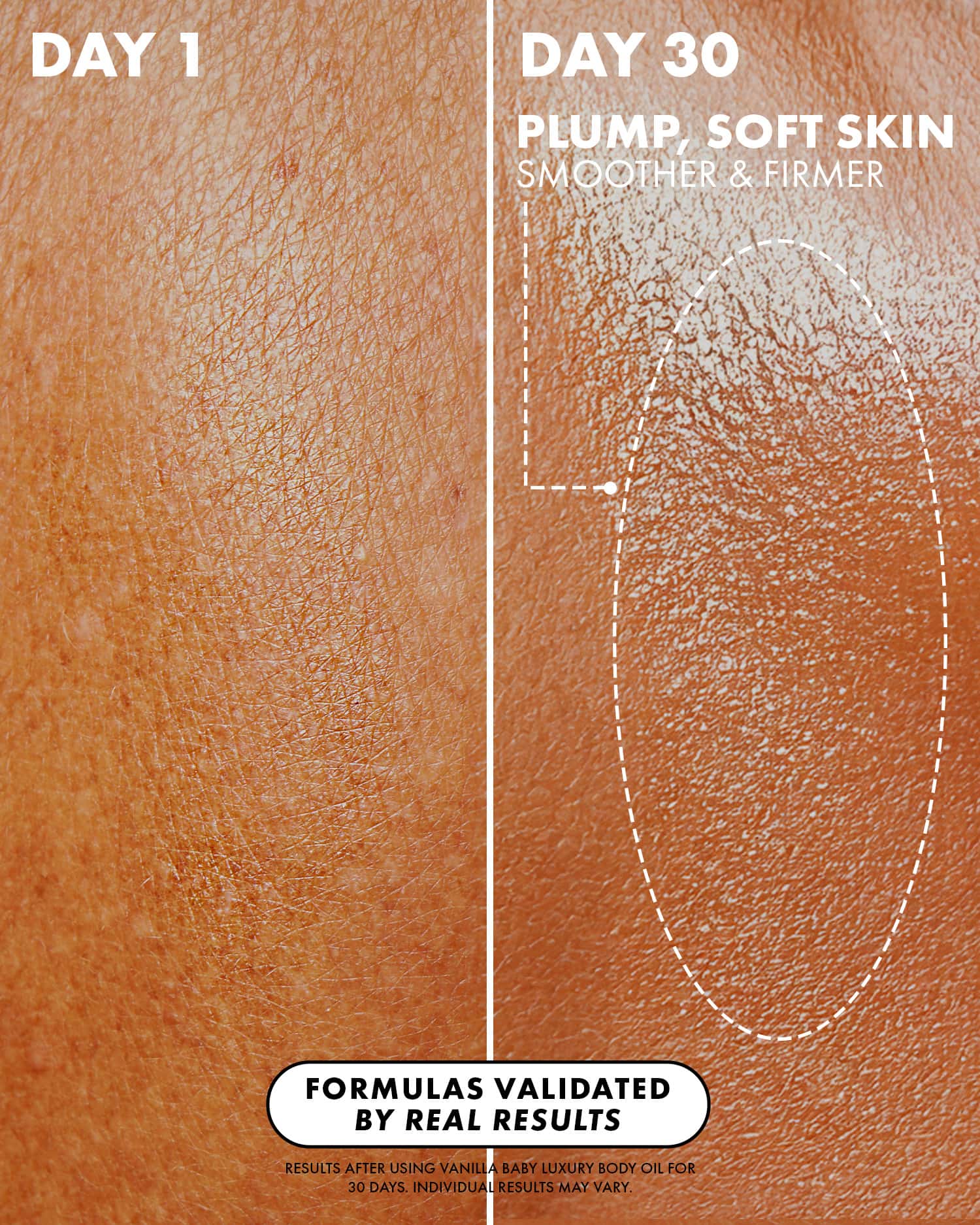 Close-up comparison of skin on day 1 (left) vs. day 30 (right) shows visibly smoother, firmer, and more hydrated skin after using Truly Beauty’s Vanilla Baby Luxury Body Oil with tightening and anti-aging benefits for 30 days.