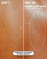 Close-up comparison of skin on day 1 (left) vs. day 30 (right) shows visibly smoother, firmer, and more hydrated skin after using Truly Beauty’s Vanilla Baby Luxury Body Oil with tightening and anti-aging benefits for 30 days.
