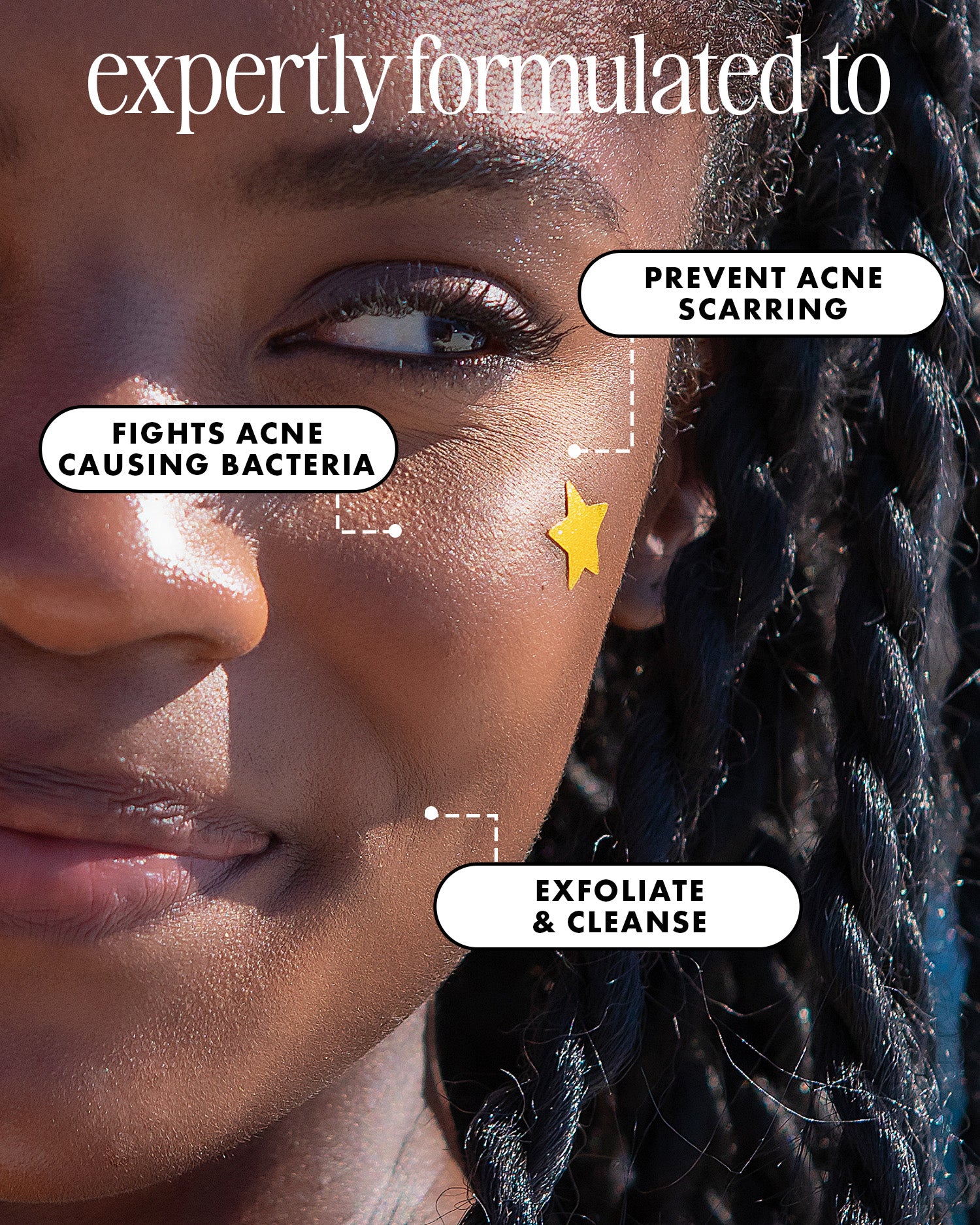 A close-up of a smiling person with dark skin and braided hair. White text bubbles point to their cheek, reading: Fights acne, Prevents scarring, & Exfoliates with tea tree oil. Featuring Truly Beauty Our Stars Pre-Game Blemish Patches.