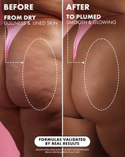 Side-by-side comparison of bare buttocks in pink underwear, showing before (dry, lined skin) and after glowing, smooth results from Buns Of Glowry Tightening Body Serum by Truly Beauty; dotted circle highlights dramatic texture change.