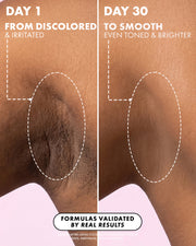Close-up of an underarm before (dark, irritated) and after (smooth, even-toned) 30 days with Truly Beauty’s Coco Cloud Ingrown Prevention and Brightening Deodorant. Text shows transformation from discolored, irritated to smooth, brighter skin in 30 days.