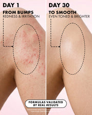 Side-by-side image: Day 1 shows red, irritated skin with bumps. By Day 30, after using Truly Beauty's Coco Cloud After Shave Serum, skin appears smooth, even-toned, and brighter—highlighting visible ingrown hair treatment results over time.