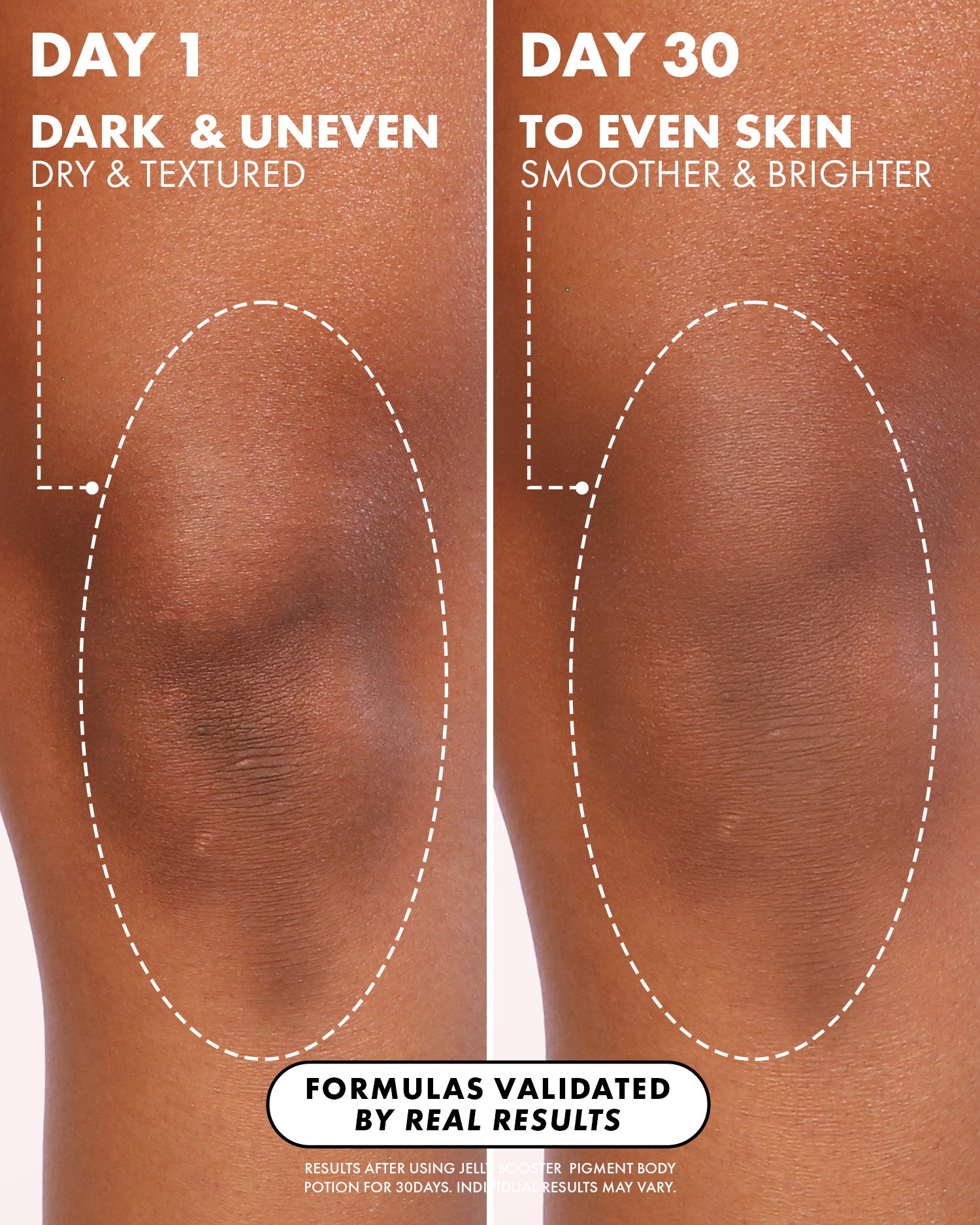 Side-by-side comparison of a knee on day 1 (dark, uneven, dry) and day 30 (brighter, smoother skin) shows visible improvement in hyperpigmentation after 30 days using Truly Beauty Jelly Booster Pigment Body Potion.