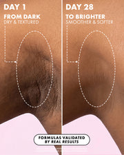 Close-up: left shows dark, dry underarm skin on Day 1; right shows brighter, smoother skin on Day 28 after using Soft Serve Serum Deodorant by Truly Beauty. White dashed ovals highlight real results.