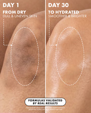 Side-by-side comparison of the same skin patch on two knees: “Day 1” shows dry, uneven skin; by “Day 30,” skin is smoother and brighter after using Truly Beauty Soft Serve After Shave Hydrating Cream. Real results, visible transformation.
