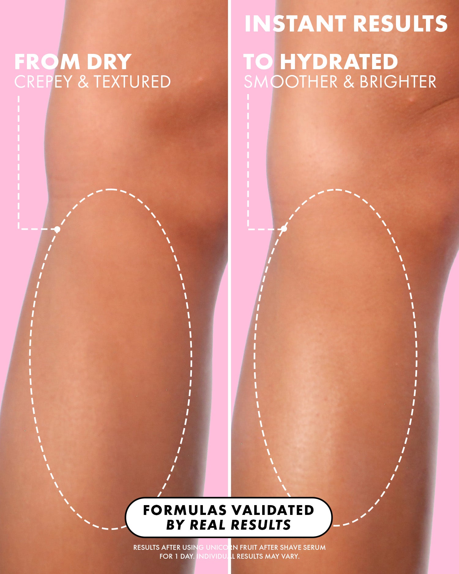 Side-by-side comparison of a knee before and after using Truly Beauty’s Unicorn Fruit After Shave Serum shows dry, rough skin on the left and smoother, hydrated skin on the right, highlighting its soothing effect on post-shave redness.