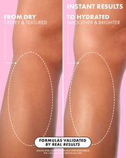 Side-by-side comparison of a knee before and after using Truly Beauty’s Unicorn Fruit After Shave Serum shows dry, rough skin on the left and smoother, hydrated skin on the right, highlighting its soothing effect on post-shave redness.