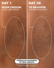 Left: uneven underarm skin with dark spots (Day 1). Right: brighter, smoother, even-toned skin (Day 30) after 4 weeks using Truly Beauty Unicorn Fruit Skin Brightening and Smoothing Deodorant with niacinamide.