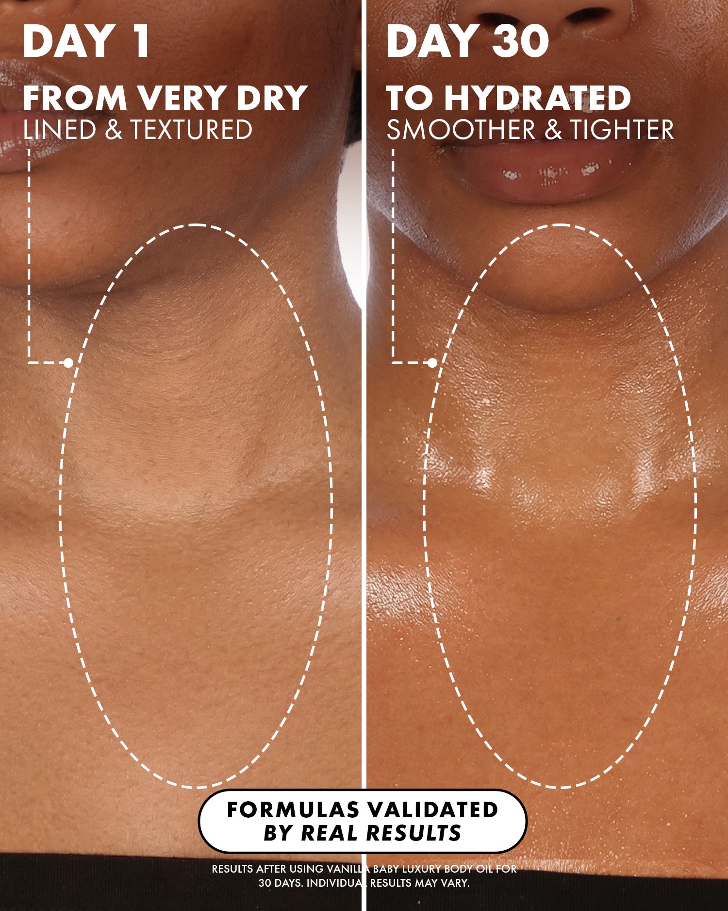 Side-by-side comparison of a person's neck. Left: Day 1, dry and lined skin. Right: Day 30, skin looks smoother and tighter after using Truly Beauty’s Vanilla Baby Luxury Body Oil with visible anti-aging results.