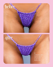 Close-up of a bikini line in a purple floral bikini bottom, shown before with ingrown bumps and after with smoother skin—text highlights hydration and healing benefits from soothing jojoba in Cooka Concentrate by Truly Beauty.