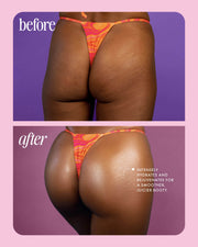 Two side-by-side photos of a person’s lower back and buttocks in orange patterned underwear: the top shows textured skin labeled before, and the bottom shows smoother skin labeled after using Buns Of Glowry Tightening Body Serum for improved hydration.