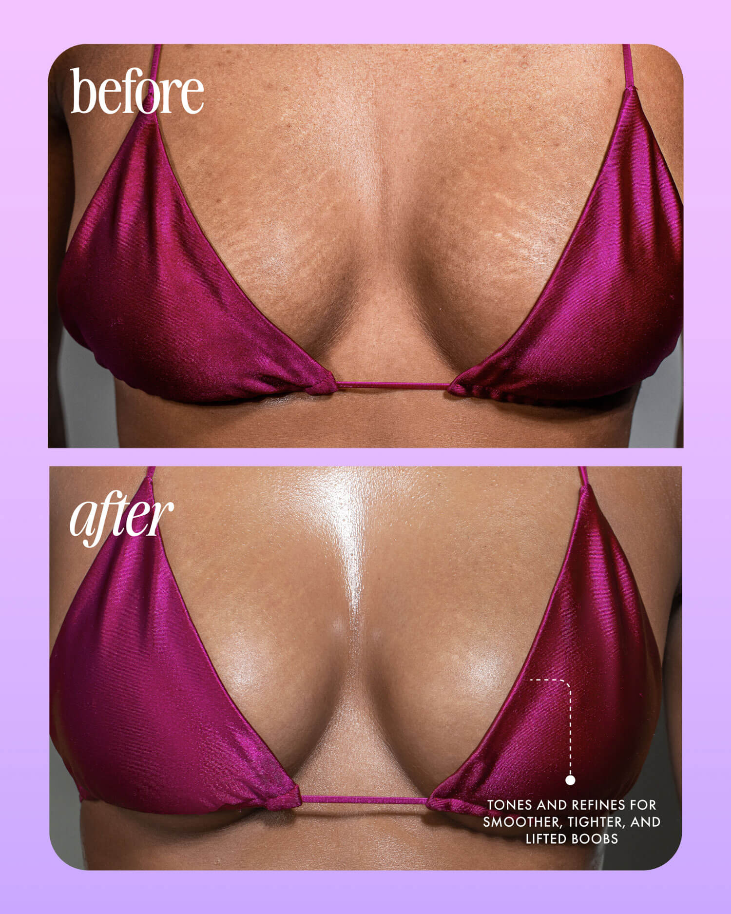 Close-up of a person’s chest in a magenta bikini top, shown in before (top) and after (bottom) images. After using Truly Beauty’s Acai Your Boobies Firming Body Serum, skin appears smoother, tighter, and lifted, as highlighted in the annotation.