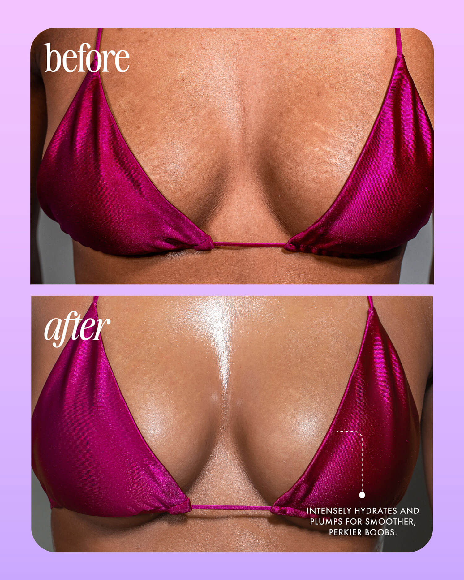 Close-up of a person’s chest in a magenta bikini top, showing “before” and “after” with Truly Beauty Acai Your Boobies Butter. Text highlights plumper, smoother skin and better hydration.