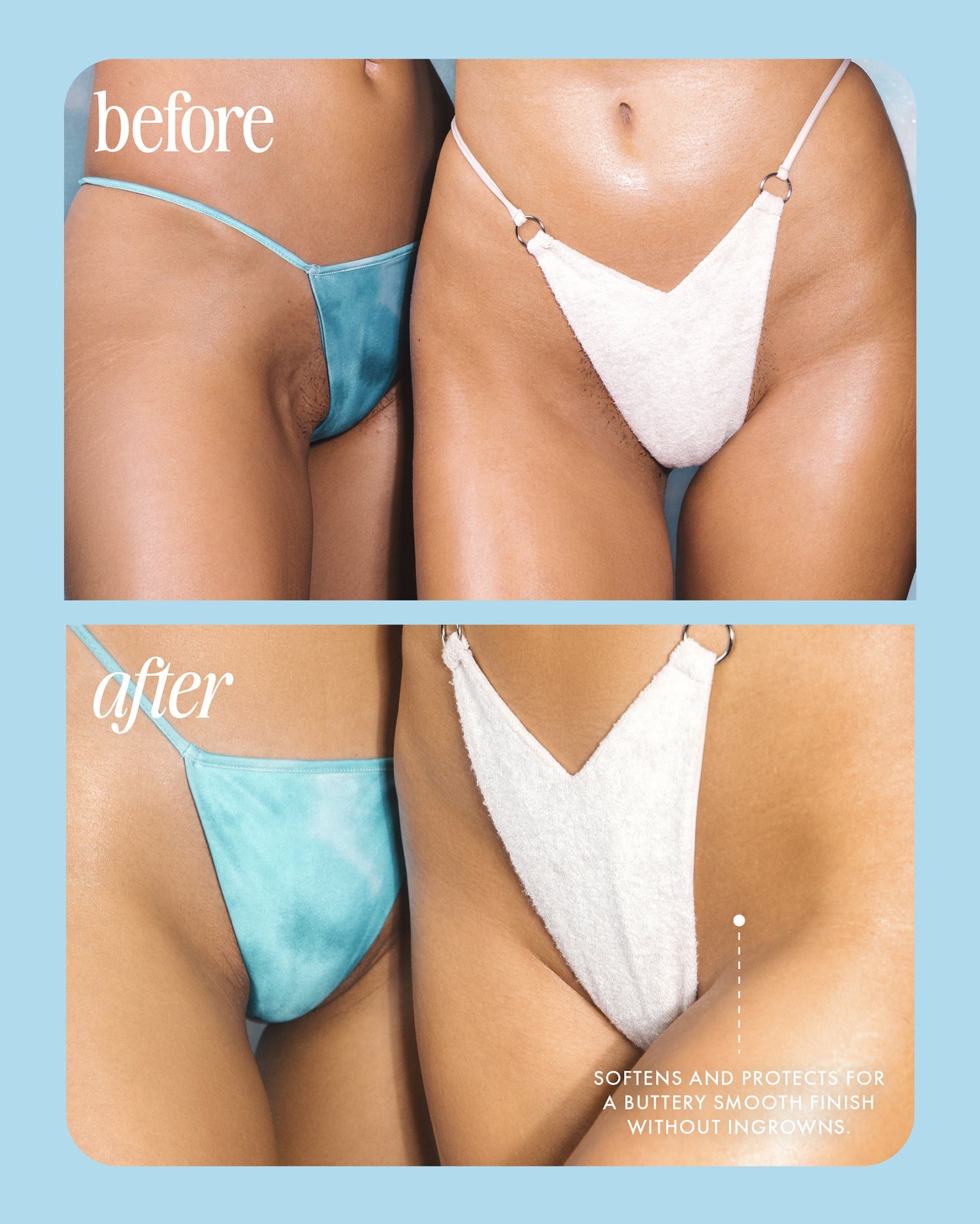 Two side-by-side images labeled before and after show close-ups of womens bikini lines in blue swimsuits. The after image highlights smoother skin, thanks to Truly Beautys Coco Cloud Luxury Shave Butter for a buttery finish without ingrowns.