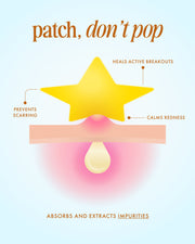 Truly Beauty’s Our Stars Prevent Scars Blemish Patches are shown as star-shaped hydrocolloid patches on inflamed skin, absorbing impurities, calming redness, aiding healing, and preventing scars, with the text: patch, don’t pop.